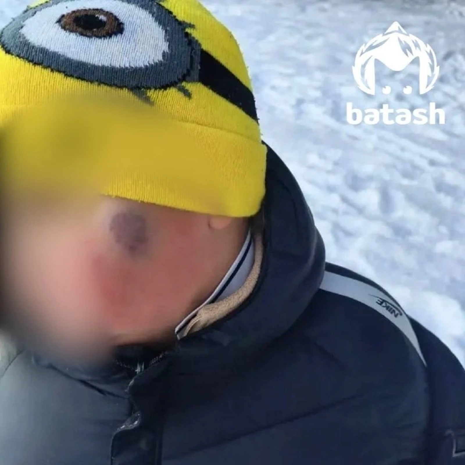 Мәктәптә малайлар сугышкан...