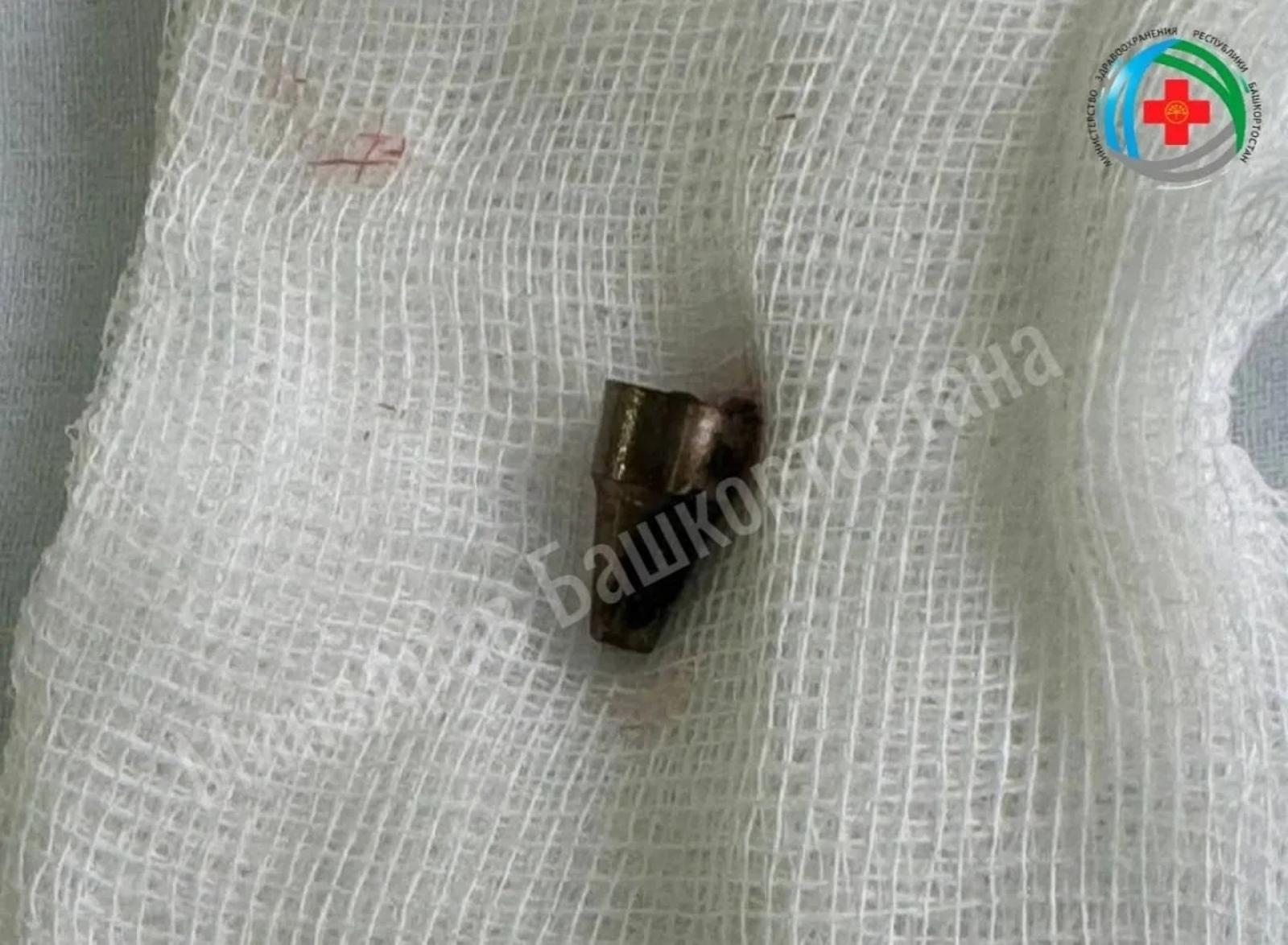 Колагында нәрсәдер барлыгын үзе дә белми яшәгән...